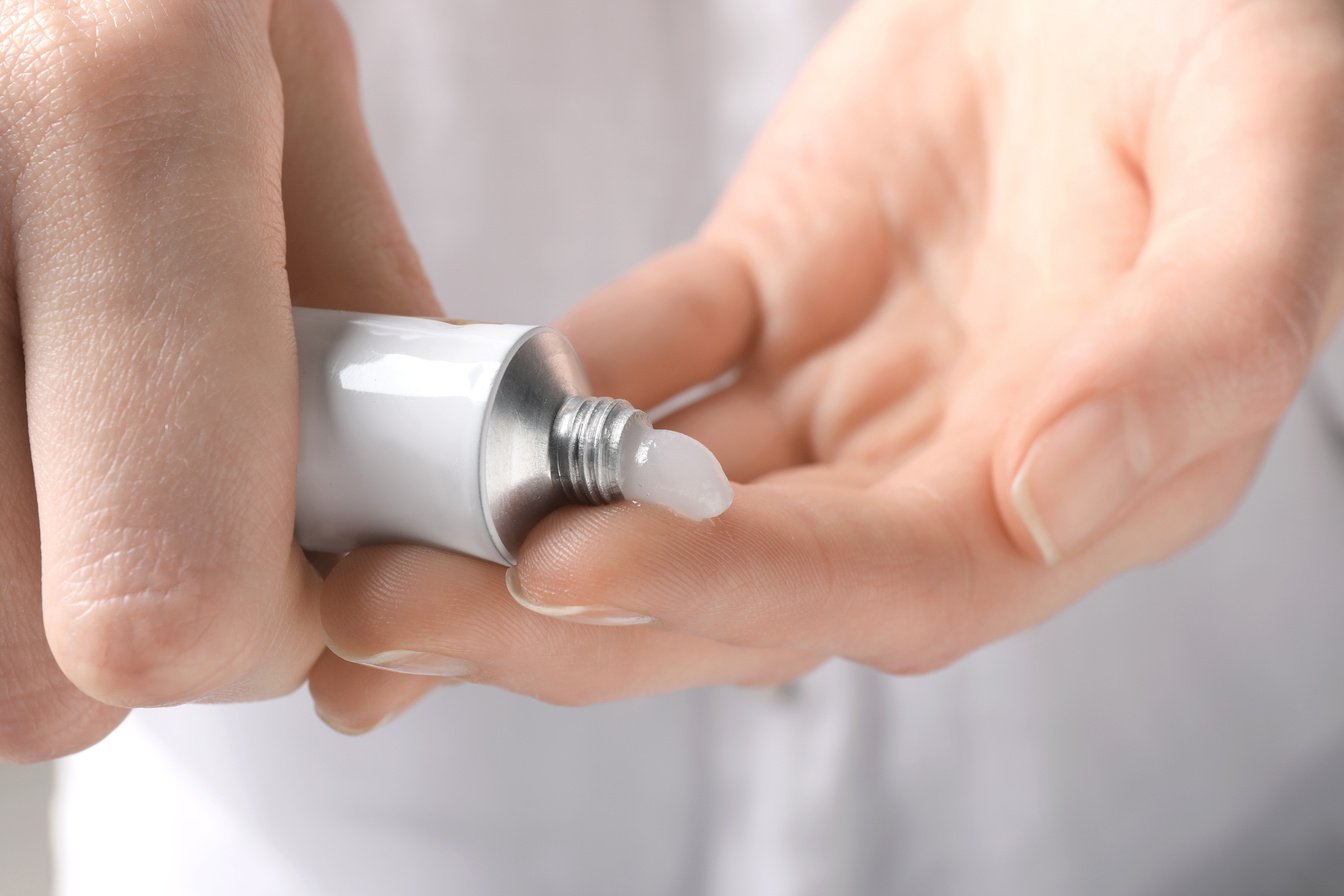 Woman Squeezing Out Ointment from Tube on Her Finger, Closeup